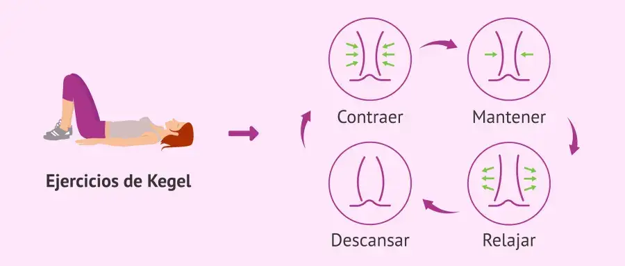 Ejercicios de Kegel