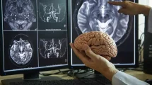 Medico estudio cerebro Alzhéimer
