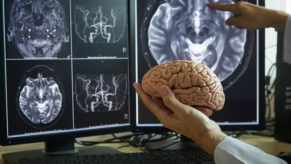 Medico estudio cerebro Alzhéimer