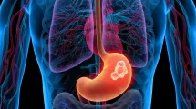 Cáncer de estomago