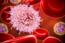Leucemia linfocítica crónica