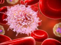 Leucemia linfocítica crónica