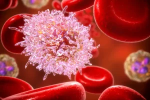 Leucemia linfocítica crónica