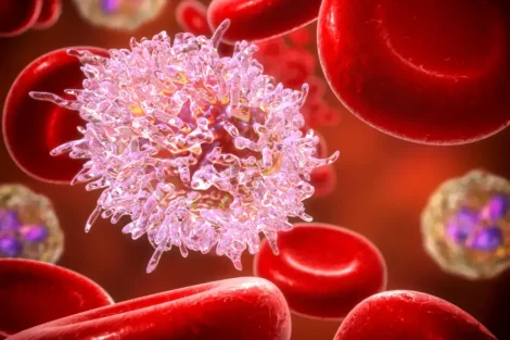 Leucemia linfocítica crónica