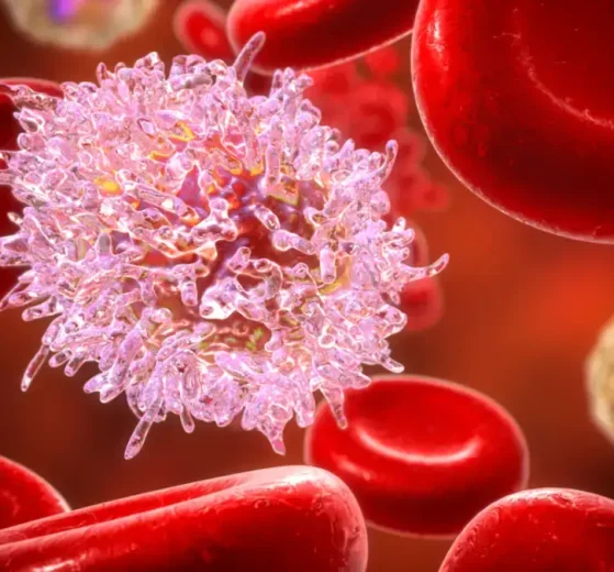 Leucemia linfocítica crónica