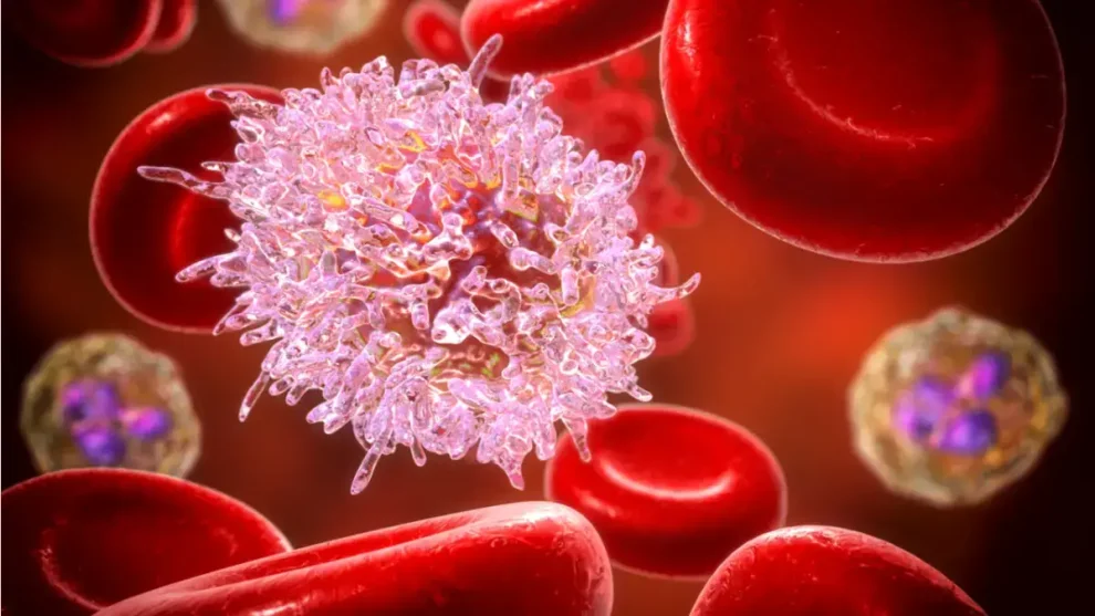 Leucemia linfocítica crónica