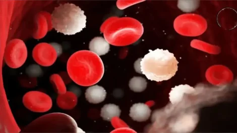 Tratamiento contra leucemia