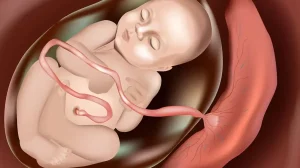 El ring de la placenta