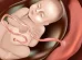 El ring de la placenta