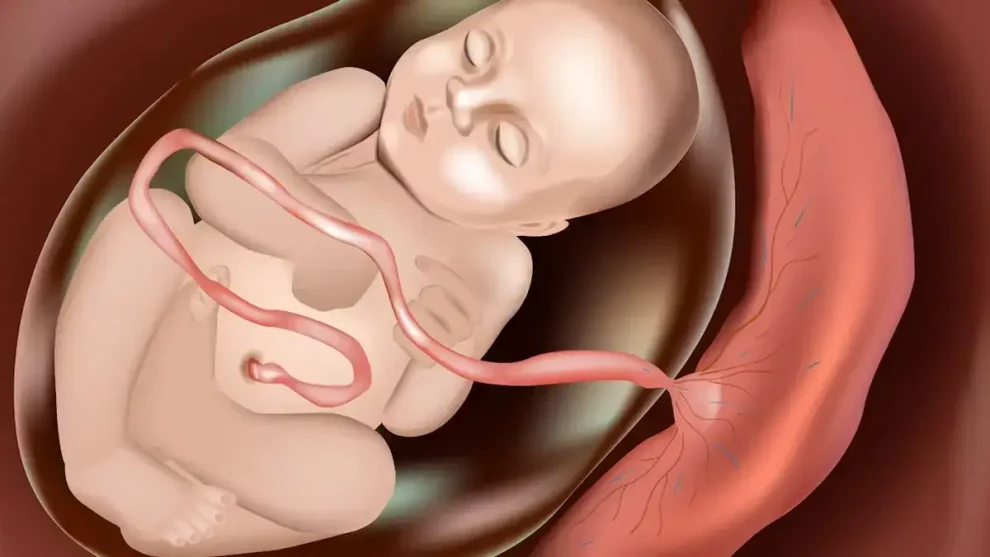 El ring de la placenta