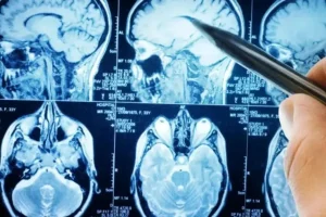 cerebro electroencefalograma