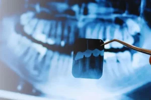 Células madre para regenerar dientes