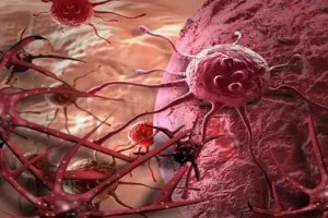 Identifican proteína causante de metástasis
