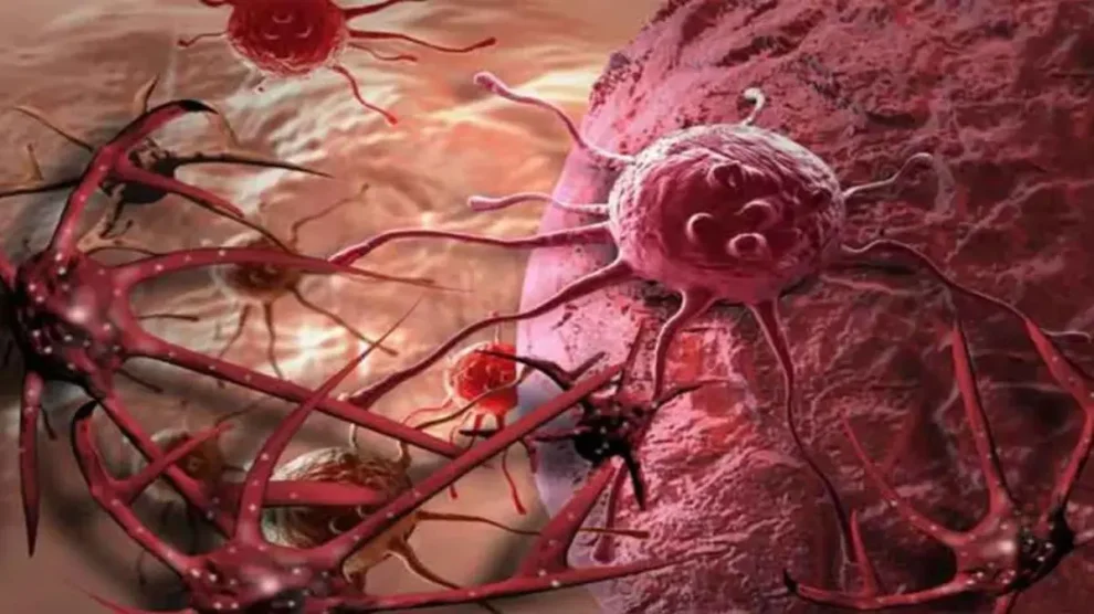 Identifican proteína causante de metástasis