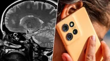 Cerebro 10 años mas joven si quitas internet