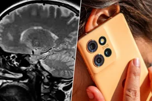 Cerebro 10 años mas joven si quitas internet