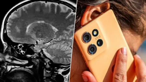 Cerebro 10 años mas joven si quitas internet