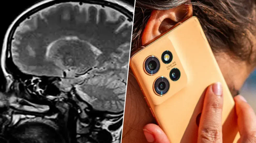 Cerebro 10 años mas joven si quitas internet