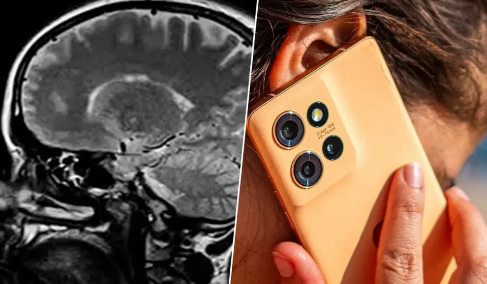 Cerebro 10 años mas joven si quitas internet