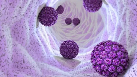 Prueba de detección de VPH