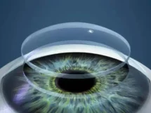 Córnea a partir de escamas de pescado