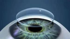 Córnea a partir de escamas de pescado