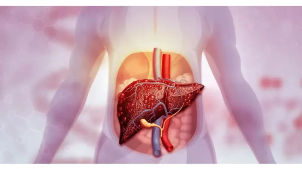 Hígado se recupera de forma natural