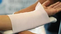 Fractura implante biodegradable
