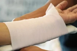 Fractura implante biodegradable